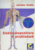 Elektroakupunktura w przykładach