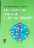 Operacyjne usuwanie zęba mądrości