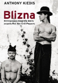 Blizna
