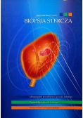 Biopsja stercza