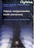 Zdjecie rentgenowskie klatki piersiowej
