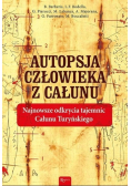 Autopsja człowieka z całunu