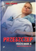 Przeszczep