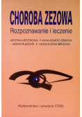 Choroba zezowa