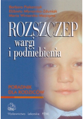 Rozszczep wargi i podniebienia