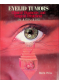 Eyelid tumors Clinical Diagnosis and Surgical Treatment