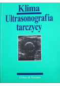 Ultrasonografia tarczycy