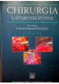 Chirurgia laparoskopowa