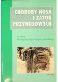 Choroby nosa i zatok przynosowych