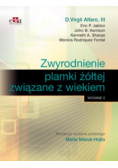 Zwyrodnienie plamki żółtej związane z wiekiem