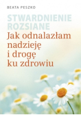 Stwardnienie rozsiane