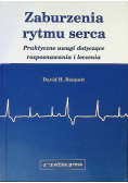 Zaburzenia rytmu serca