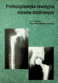 Protezoplastyka rewizyjna stawów biodrowych
