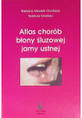 Atlas chorób błony śluzowej jamy ustnej
