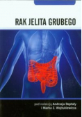 Rak jelita grubego