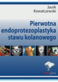 Pierwotna endoprotezoplastyka stawu kolanowego