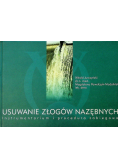 Usuwanie złogów nazębnych