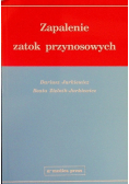 Zapalenie zatok przynosowych