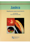 Jaskra Współczesne zasady rozpoznawania