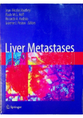 Liver Metastases