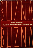 Blizna po cięciu cesarskim