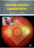 Choroby zakaźne i pasożytnicze