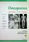 Osteoporoza aktualny stan wiedzy