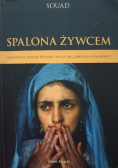 Spalona żywcem