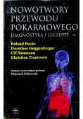 Nowotwory przewodu pokarmowego