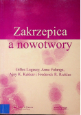 Zakrzepica a nowotwory