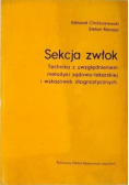 Sekcja zwłok