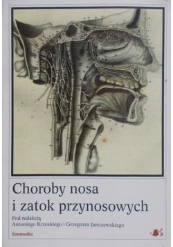Choroby nosa i zatok przynosowych