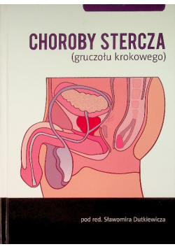 Choroby stercza gruczołu krokowego