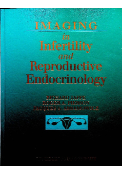 Imaging in infertility and reproductive endoctinology