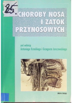 Choroby nosa i zatok przynosowych