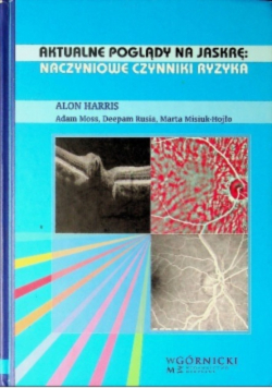 Aktualne poglady na jaskre naczyniowe czynniki ryzyka
