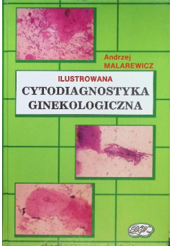 Cytodiagnostyka ginekologicznego