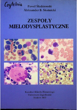 Zespoły mielodysplastyczne