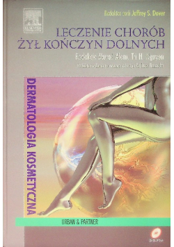 Leczenie chorób żył kończyn dolnych