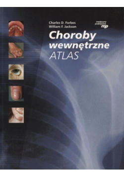 Choroby wewnętrzne atlas