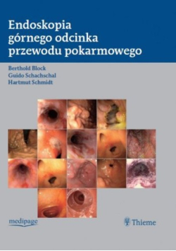 Endoskopia górnego odcinka przewodu pokarmowego