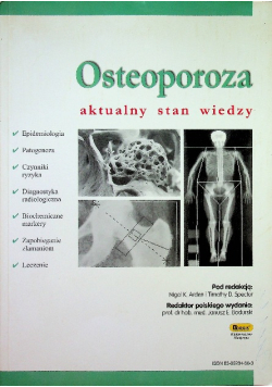 Osteoporoza aktualny stan wiedzy
