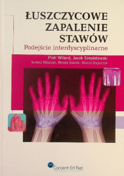 Łuszczycowe zapalenie stawów