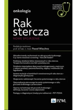 Rak stercza Nowe spojrzenie