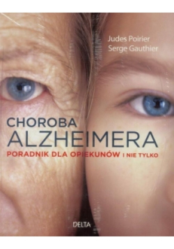 Choroba Alzheimera