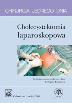 Chirurgia jednego dnia Cholecystektomia laparoskopowa