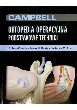 Campbell Ortopedia Operacyjna Tom 2