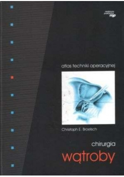 Chirurgia wątroby