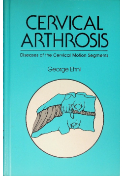 Cervical Arthrosis