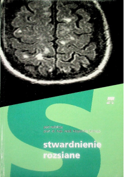 Stwardnienie rozsiane